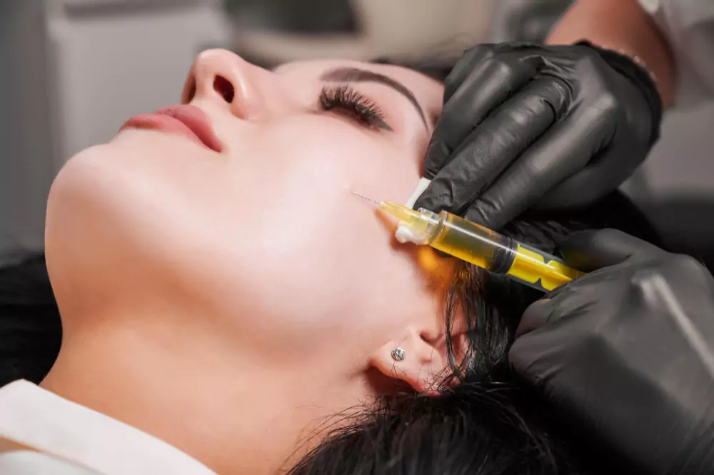 Face PRP Treatment